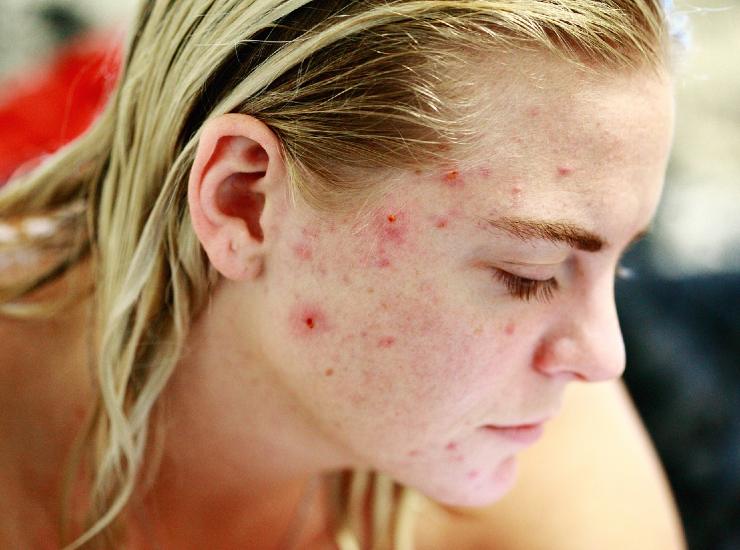 Make-up naturale da uomo: coprire le imperfezioni