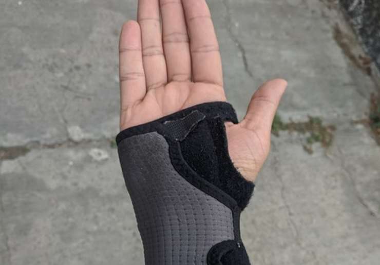 Tunnel carpale e soluzioni